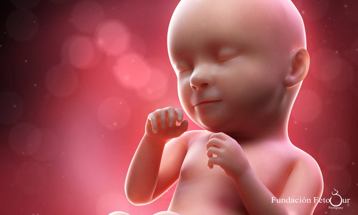 Anemia Fetal y Transfusiones Intrauterinas